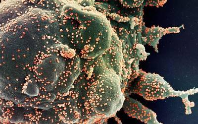 Beste koronabirus kasu bat detektatu dute Zumaian