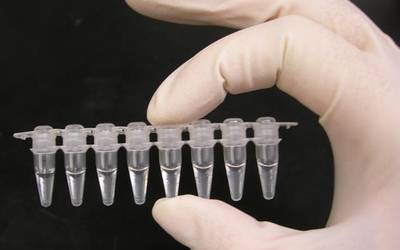 Eusko Jaurlaritzari test masiboak egiten hasteko eskatu dio EHUko irakasle-talde batek