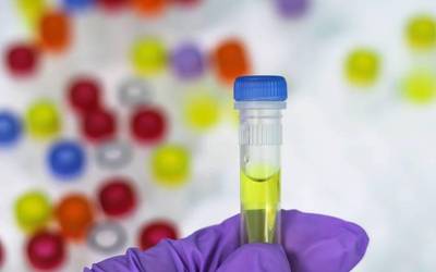 EHUko milatik gora irakaslek egin dute bat PCR testen gaineko adierazpenagaz