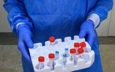 Herritar batek positibo eman du PCR proban