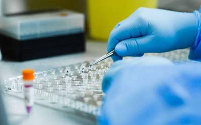 Azken PCR probetan lau kasu positibo hauteman ditu Osakidetzak Azkoitian