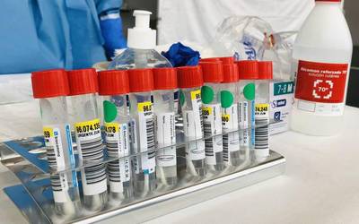 34 positibo berri atzeman dituzte asteon Elgoibarren, joan zen astean baino bi gehiago