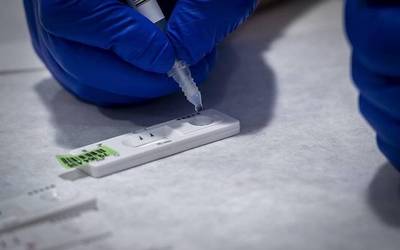 Bi positibo gehiago azken orduetan: bana Lesakan eta Leitzan