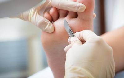 Podologia zerbitzua Landatxopeko lokalera itzuliko da