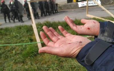 Hainbat langile zaurituta Tubacexeko grebaren 43. egunean