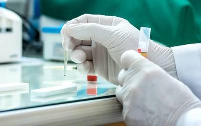 Positiboak behera, intzidentzia tasa gorabeheratsu
