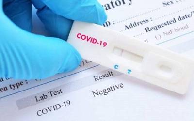Ostegunean hasiko dira COVID-19aren autodiagnostikorako testak farmazietan saltzen