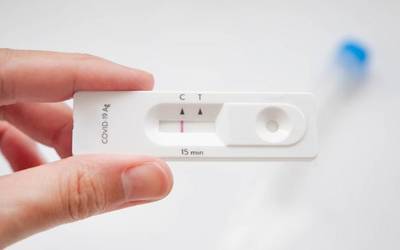 Nola egiten dira antigenoen testak?