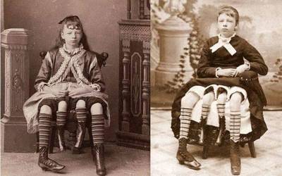 Josephine Myrtle Corbin, trabak gainditu zituen lau hankako emakumea