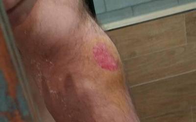 Ertzaintzak foamezko balak erabili zituela salatu dute Urduñako tabernan zeuden herritarrek