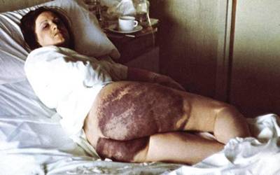 Amparo Arangoa leitzarra ere torturaren biktima izan zela aitortu du Nafarroako Gobernuak